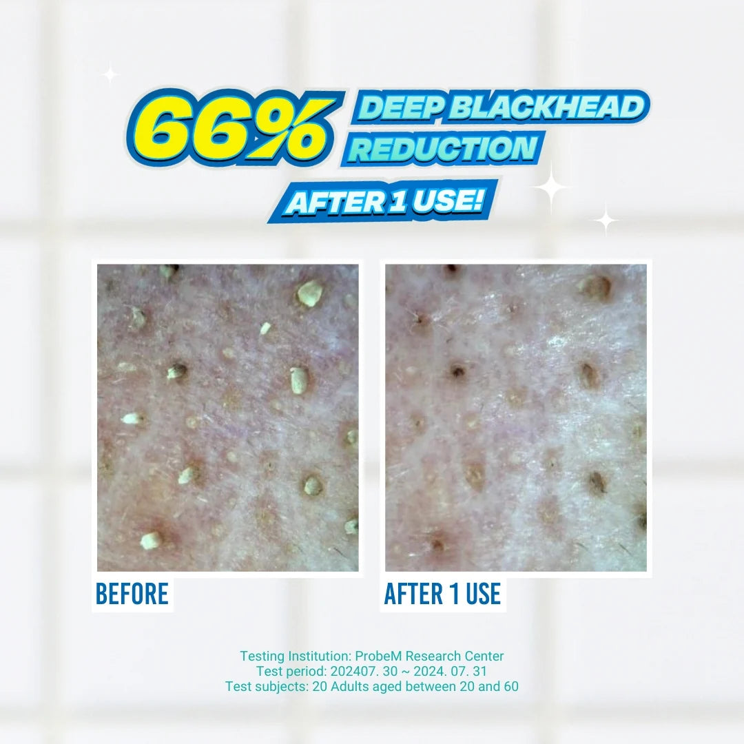 [Jumiso] Blackhead melting softner 150ml + cotton pad(40pads) + cotton Swab 10ea
