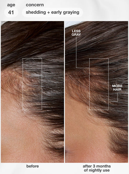 K18 FutureIQ™ biomimetic hair longevity serum